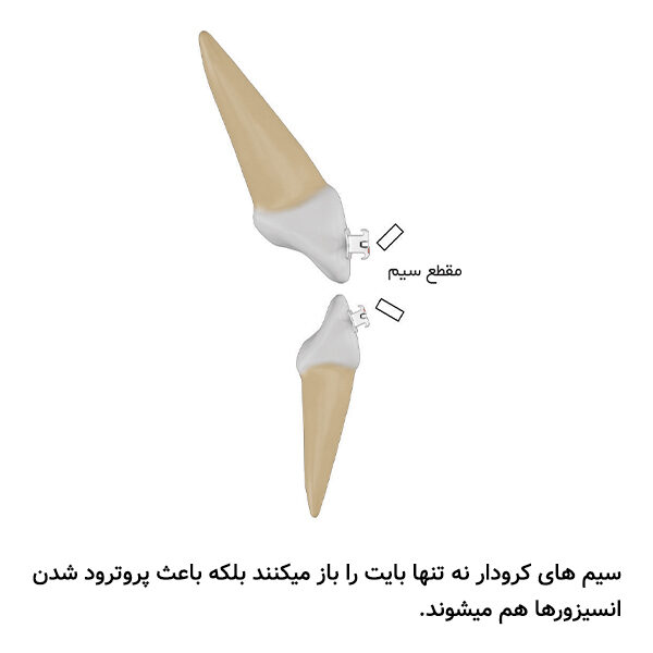 سیم سوپرالاستیک کرودار بیضی آمریکایی